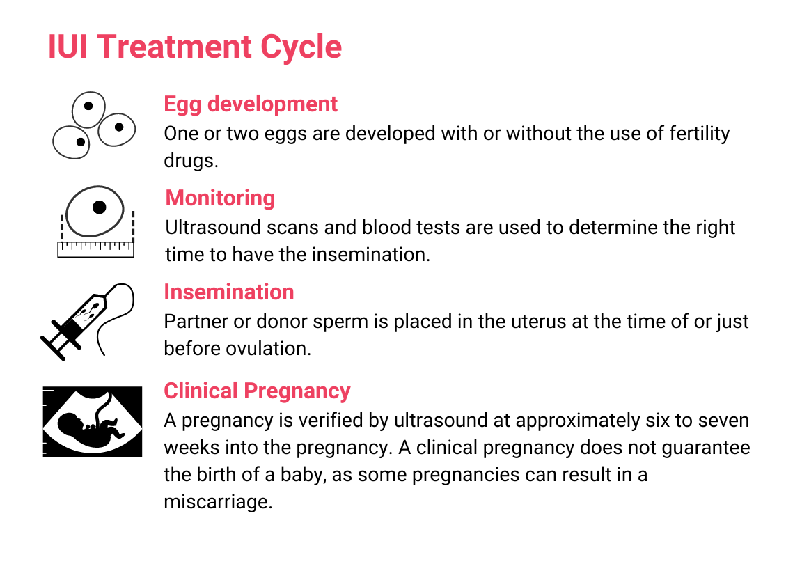 IUI process image