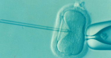 What you need to know about IVF ‘add-ons’