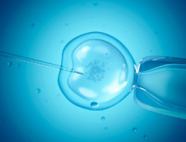 IVF image